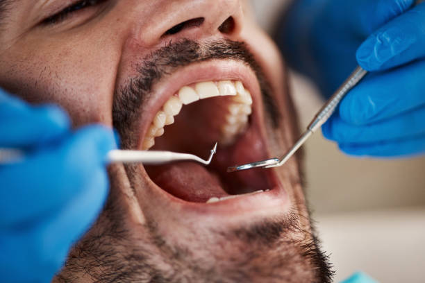 Best Emergency Tooth Extraction in Orange, OH